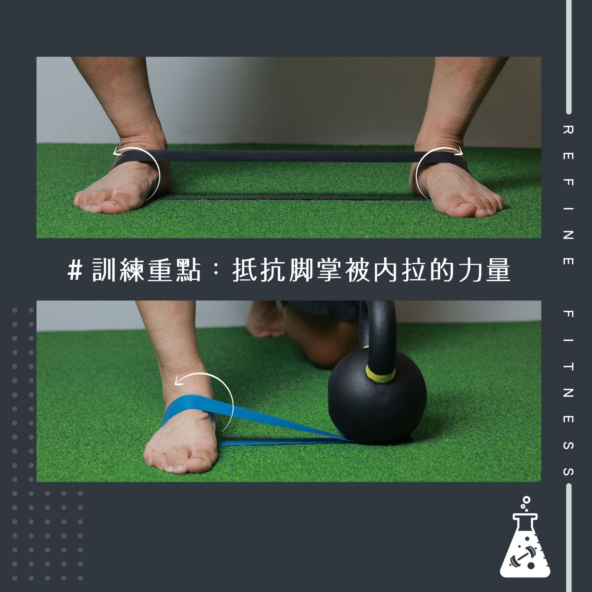 可能跟足弓塌陷有很大的關係！
